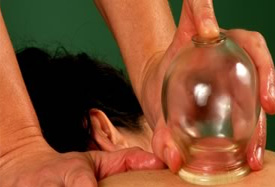 Vitality Massage Inc. - Cupping