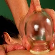 Vitality Massage Inc. - Cupping Therapy